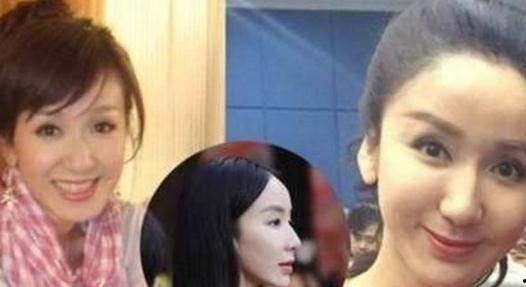 明星取假体,假体植入背后的美丽秘密