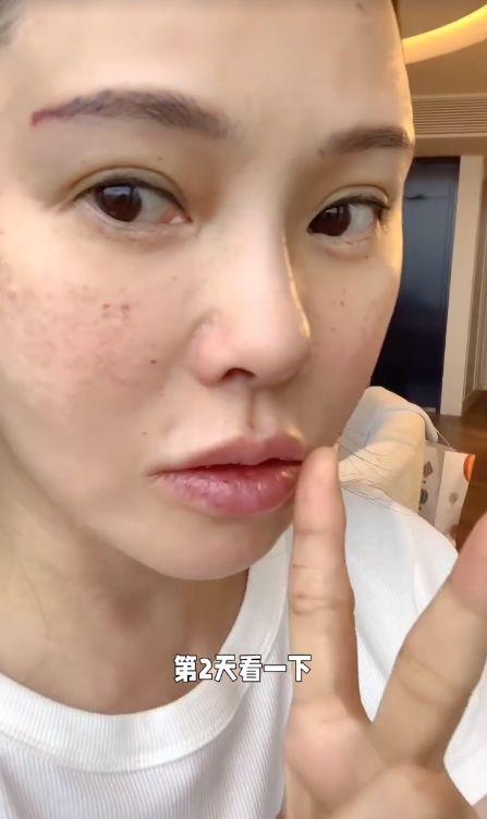 满脸针眼明星,揭秘明星满脸针眼的背后故事