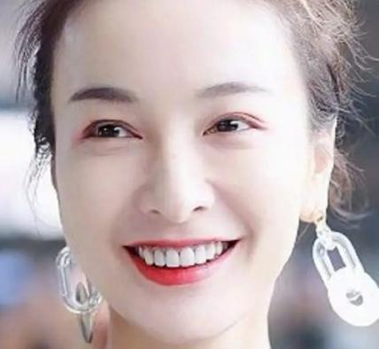 哪些明星有烤瓷牙,美丽笑容背后的秘密